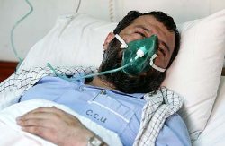 کشف داروی ضد سرفه برای جانبازان شیمیایی