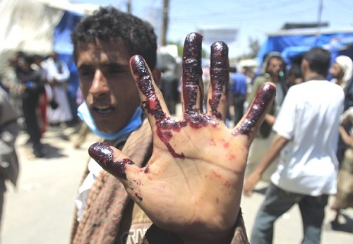 آخرین خبرها از تجاوز نظامی عربستان به یمن