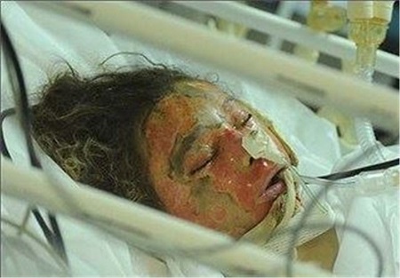 مرگ دلخراش خواهر و برادر خردسال